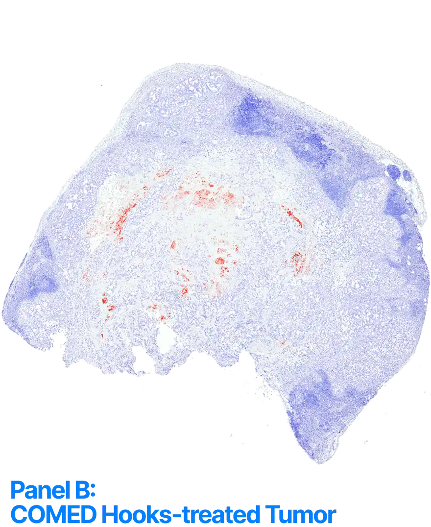 gr-Panel-COMEDHooksTreatedTumor